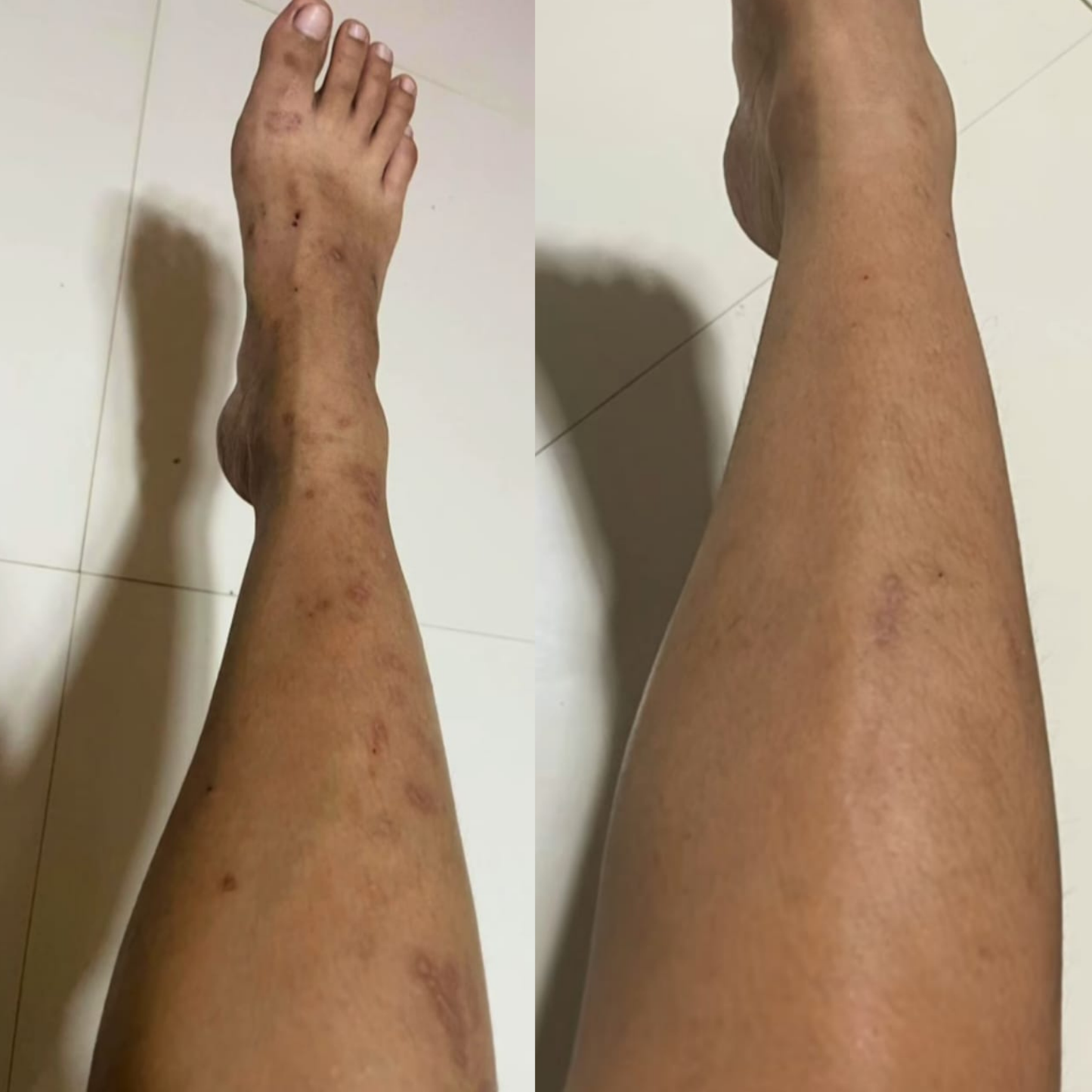 GEL REPARATRICE ANTI-CICATRICE YOXIER