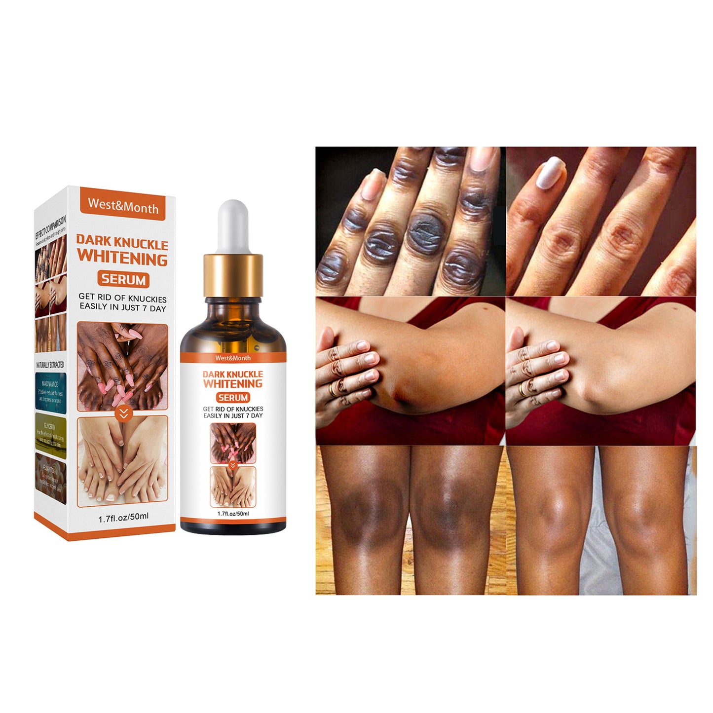 Sérum Correcteur des Zones Sombres en 7 jours